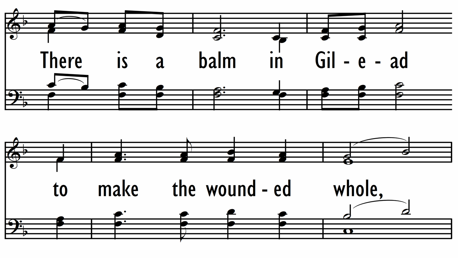 THERE IS A BALM IN GILEAD-ppt